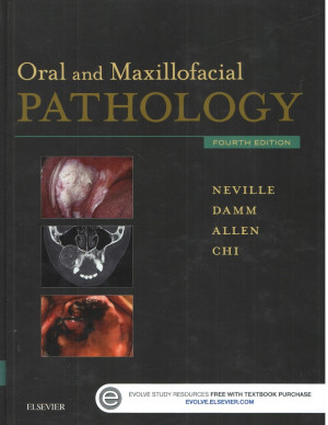 Image of Oral and Maxillofacial Pathology