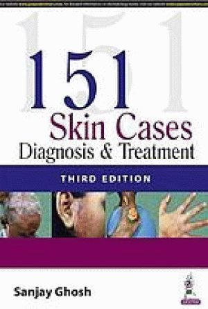 Image of 151 Skin Cases: Diagnosis & Treatment