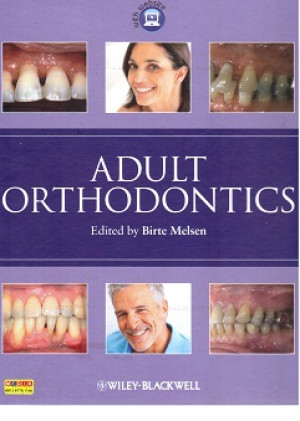Image of Adult Orthodontics