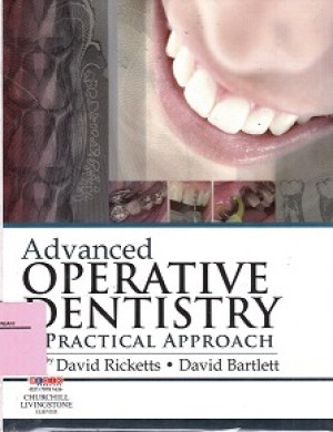Image of Advanced Operative Dentistry A Practical Approach