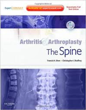 Image of Arthritis & Arthroplasty: The Spine