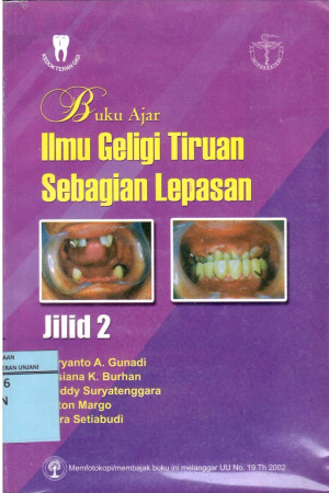 Image of Buku Ajar Ilmu Geligi Tiruan Sebagian Lepasan Jilid 2