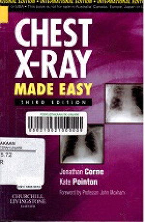 Image of Chest X-Ray Made Easy