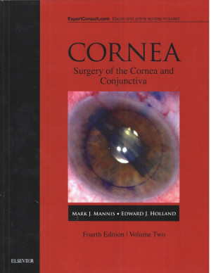 Image of CORNEA surgery of the cornea and conjunctiva vol 2