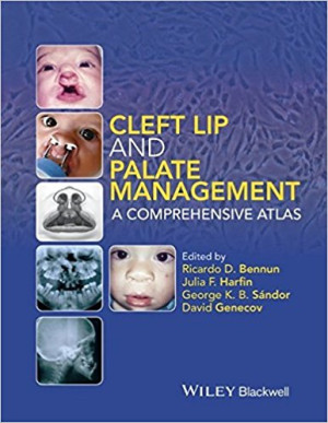 Image of Cleft lip and Palate Management (A comprehensive Atlas)