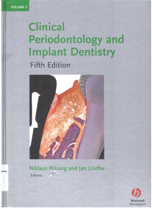 Image of Clinical Periodontology and Implant Dentistry Volume 2