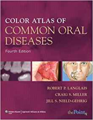 Image of Color Atlas of Common Oral Diseases