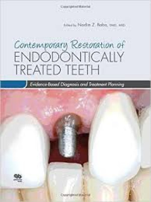 Image of Contemporary Restoration of Endodontically Treated Teeth : Evidence- Based Diagnosis and Treatment Planning