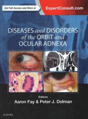 Image of DISEASES and DISORDERS of the ORBIT and OCULAR ADNEXA