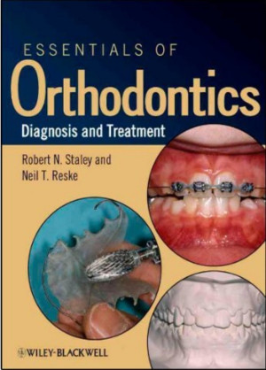Image of Essentials of Orthodontics Diagnosis and Treatment