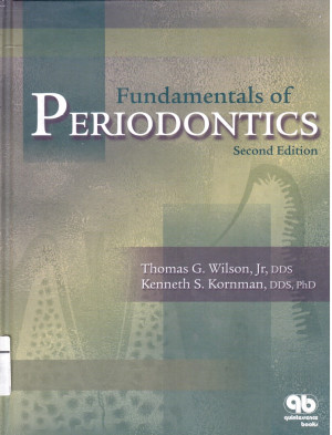 Image of Fundamentals of Periodontics