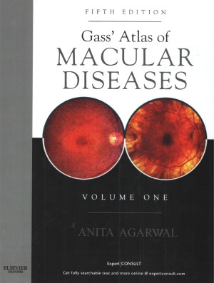 Image of gass'atlas of MACULAR DISEASES VOL 2
