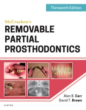 Image of McCracken's Removable partial Prosthodontics
