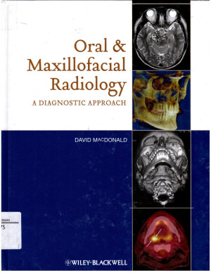 Image of Oral and Maxillofacial Radiology a Diagnostic Approach