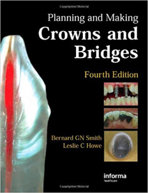 Image of Planning and Making Crowns and Bridges