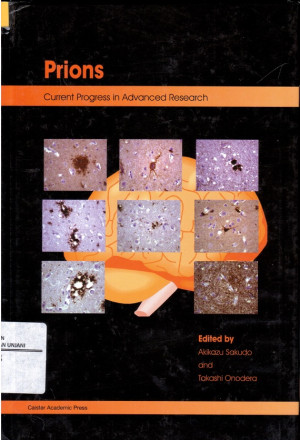 Image of Prions ; Current Progress in Advanced Research