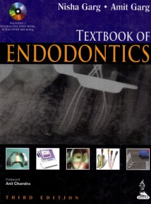 Image of Textbook of Endodontics