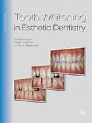 Image of Tooth whitening in esthetic dentistry : Tooth whitening Communication Tool
