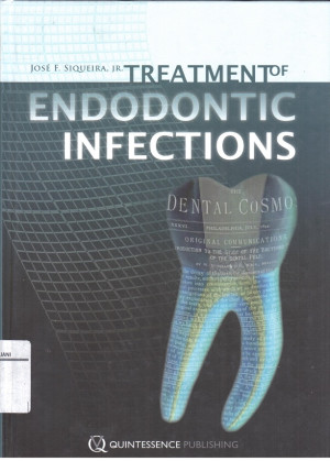 Image of Treatment of Endodontic Infections