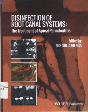 Image of Disinfection of Root Canal Systems : The Treatment of Apical Periodontitis