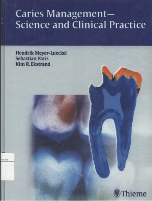 Image of Caries Management-Science and Clinical Practice