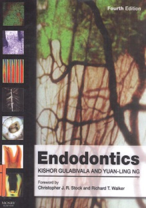 Image of endodontics