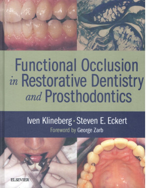 Image of Functional Oclusion in Restorative Dentistry and Prosthodontics