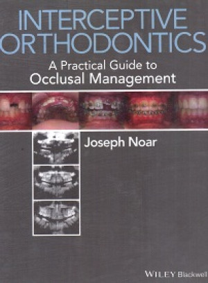 Image of Interceptive Orthodontics a Practical Guide to Occlusal Management