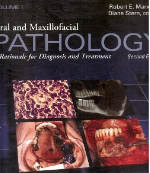 Image of Oral and Maxillofacial Pathology A Rationale For Diagnosis And Treatment Volume1