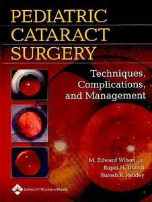 Image of Pediatric Cataract Surgery : Techniques, Complications, and Management
